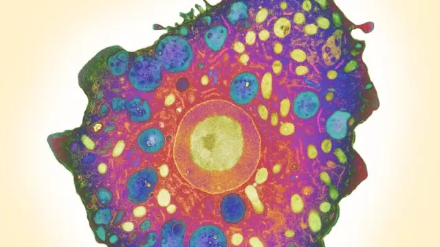 Naegleria fowleri: What You Need to Know About the Dangerous Amoeba