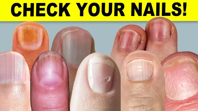 What Your Nails Can Reveal About Your Health